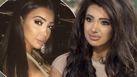 chloe khan nose surgery